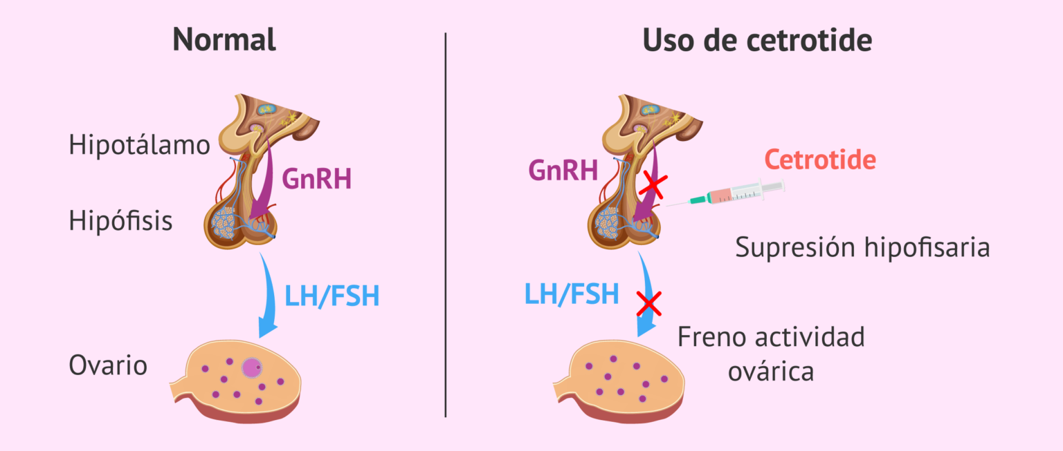 Aceoto Plus Gotas: Prospecto, Usos y dosificación - Solución ótica 3mg/ml