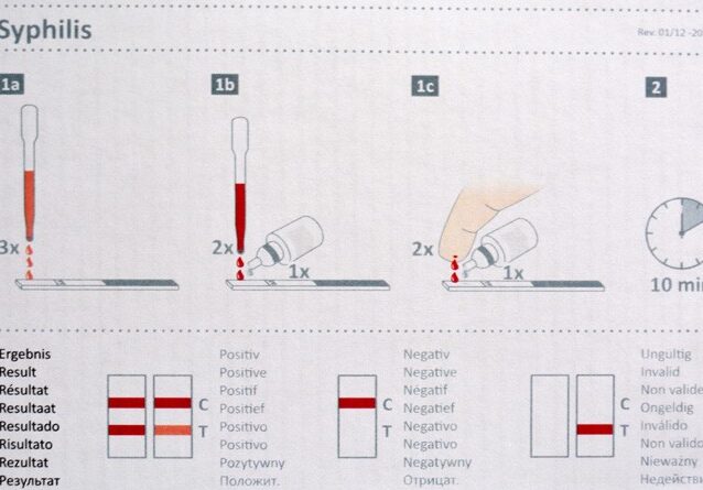¿Cómo hacer un test casero de sifilis? – Guía y pasos sencillos