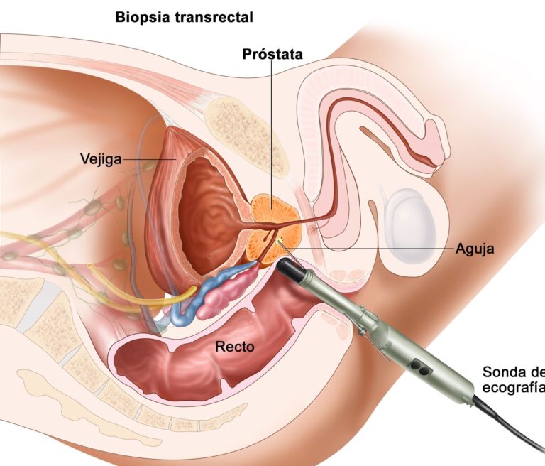 Conducir después de una biopsia de próstata: información sobre TOOKAD 366 mg